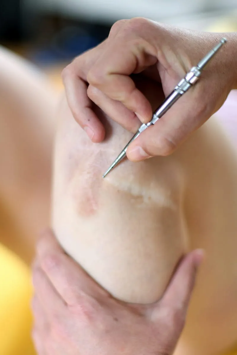 Narbe Knie