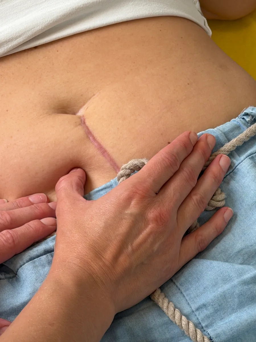 sanfte Narbenbehandlung in Graz